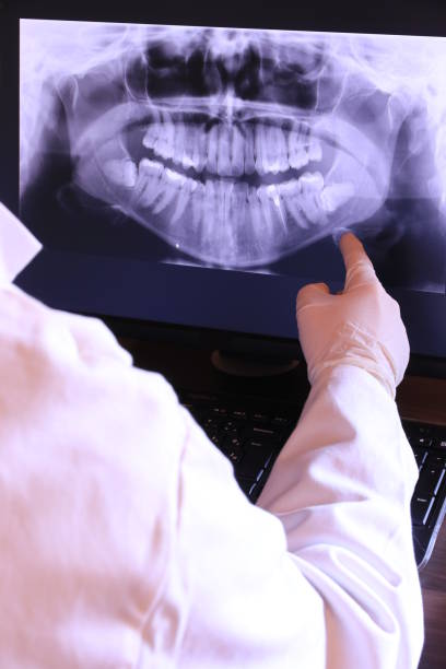 Best Emergency Broken Tooth Repair in Heyworth, IL