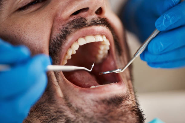 Best Emergency Root Canal Treatment in Heyworth, IL