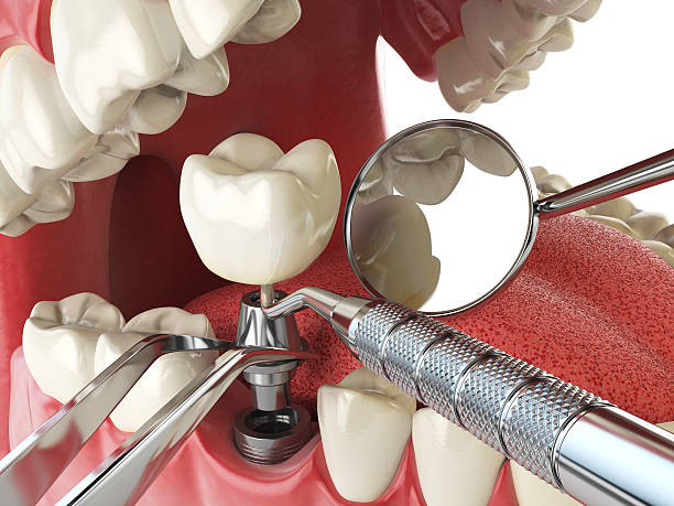 Best Weekend Emergency Dentist in Heyworth, IL