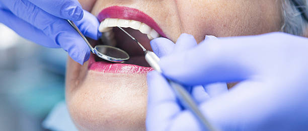Best Emergency Tooth Extraction in Heyworth, IL